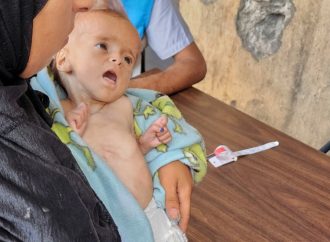 “الأونروا”: عدد الوفيات نتيجة سوء التغذية أكبر بكثير من العدد المعلن