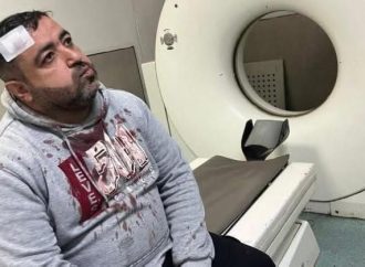 ضبط المعتدين على الزميل الصحفي فيصل التميمي